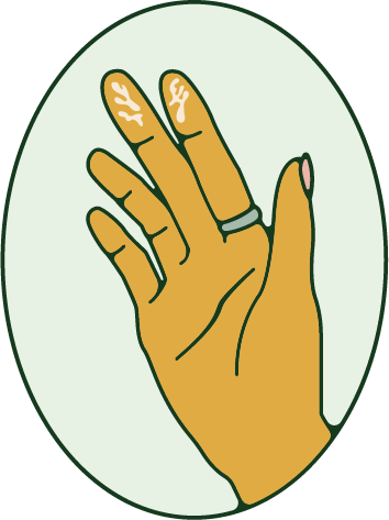 corpus luteum discharge