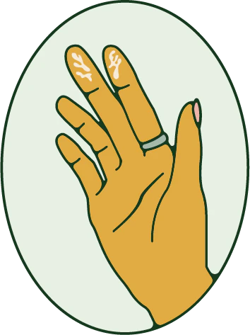corpus luteum discharge