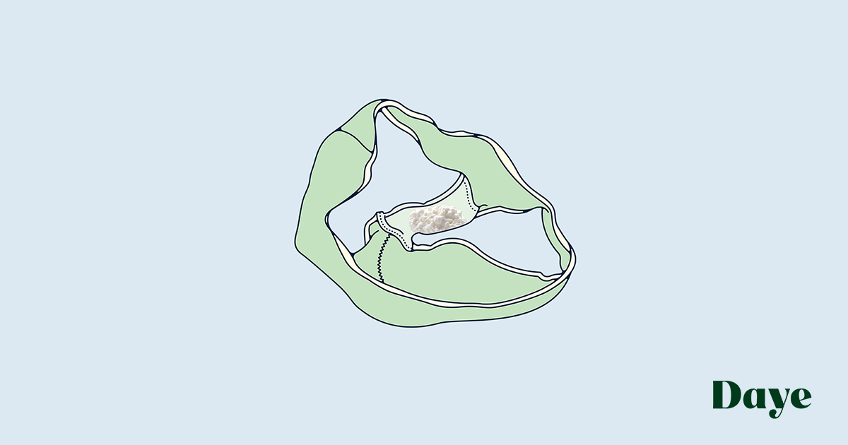 Can Tampons Cause Yeast Infections