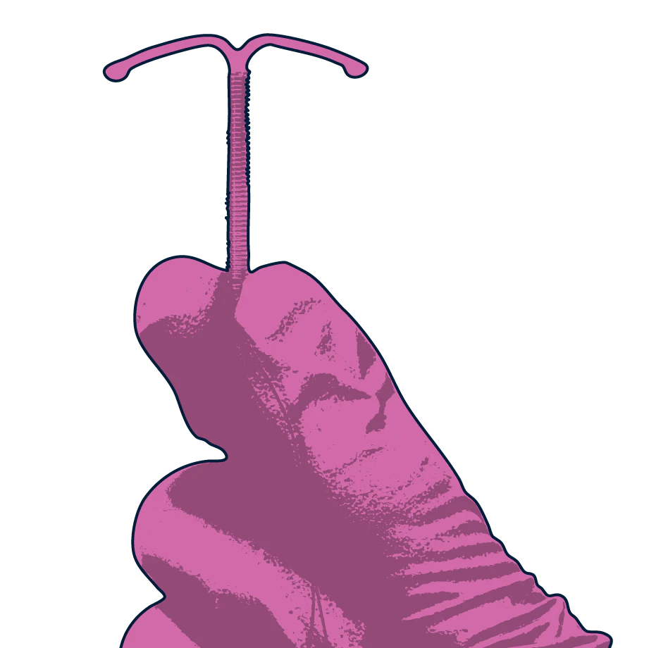 hormonal coil illustration