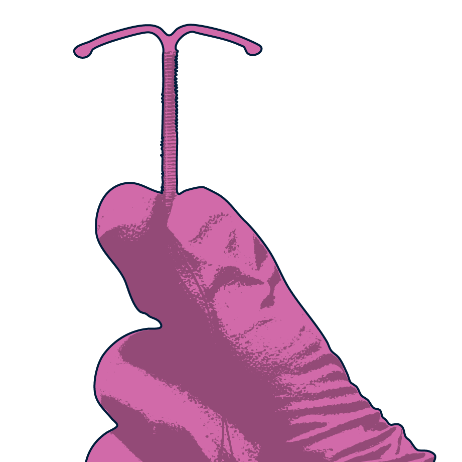 hormonal coil illustration