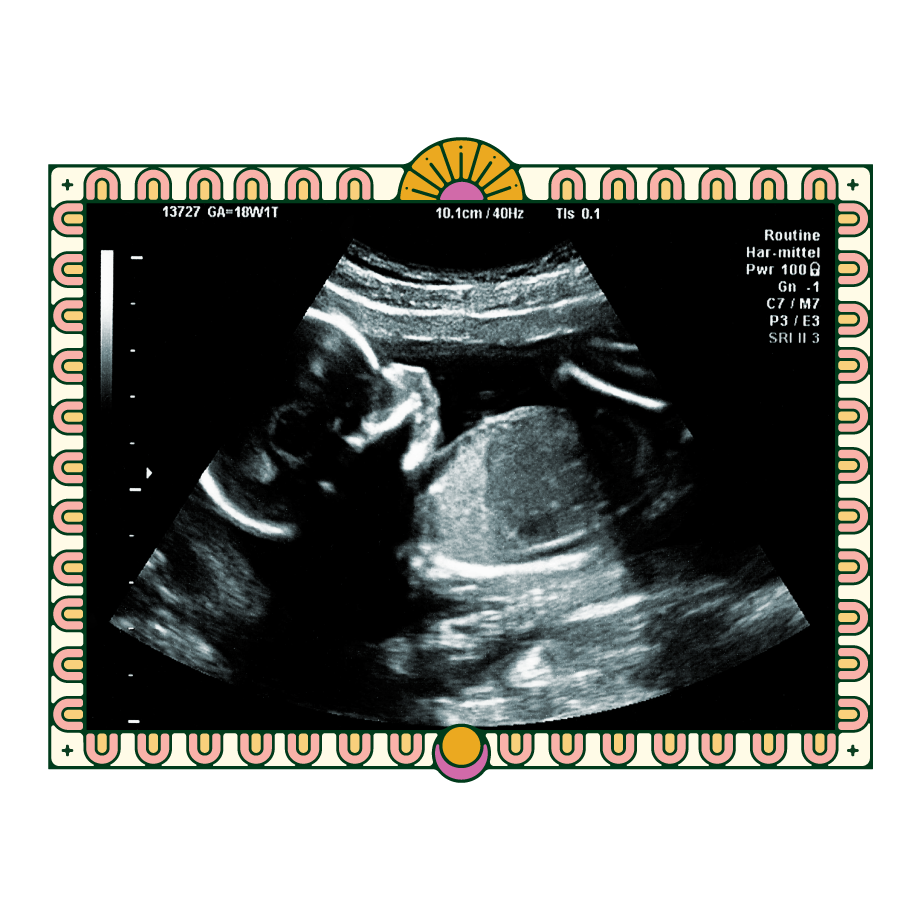 pregnancy sonogram