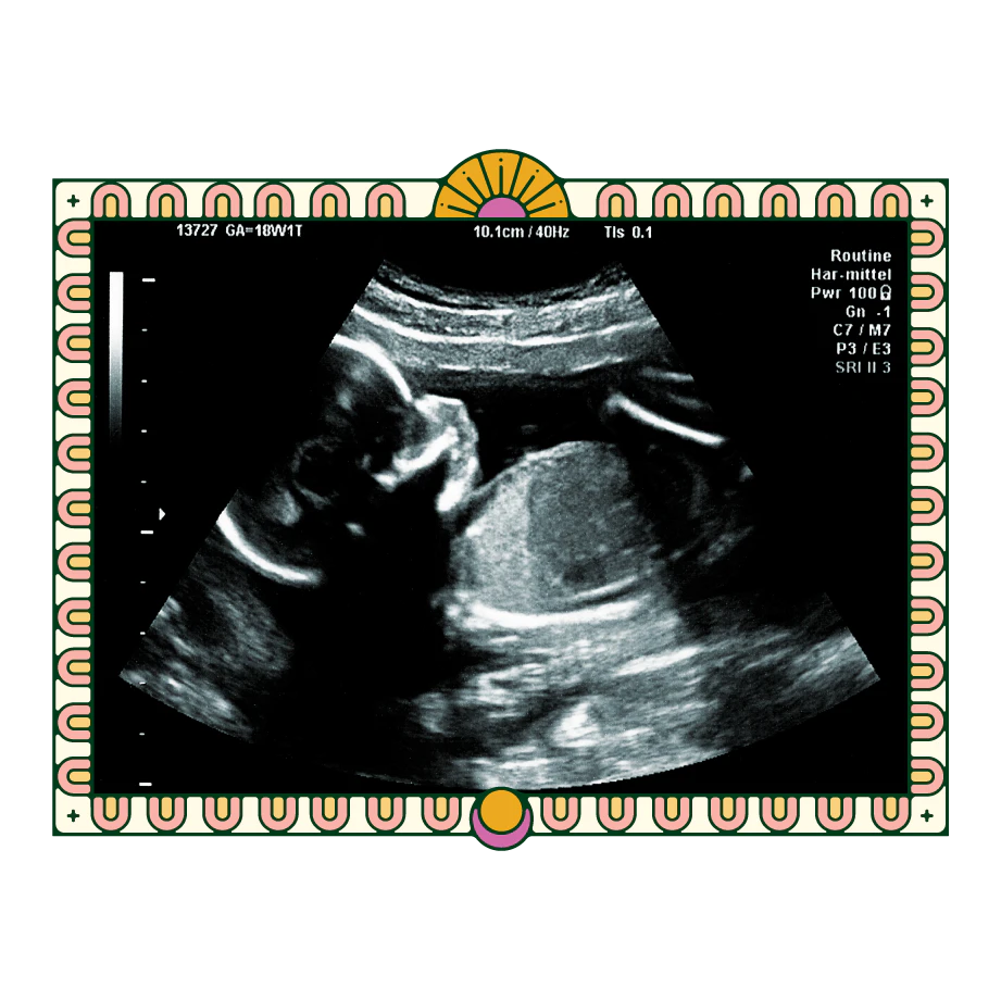 pregnancy sonogram