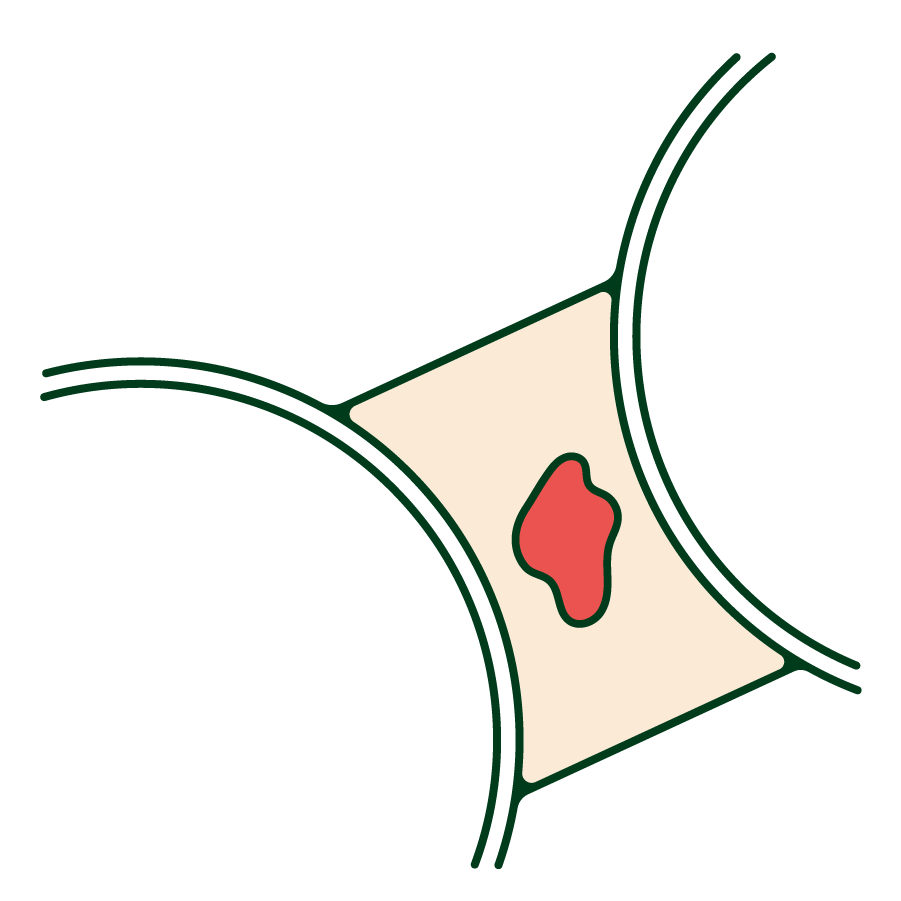 vaginal bleeding