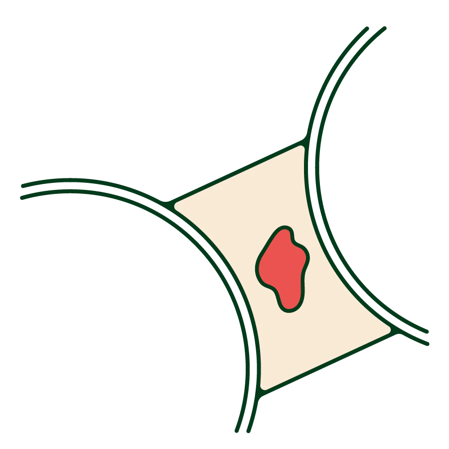vaginal bleeding