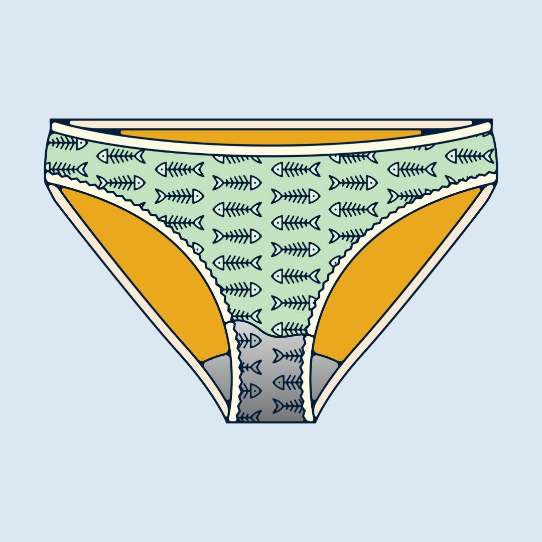 My vagina always has a fishy odour. Is that bacterial vaginosis?