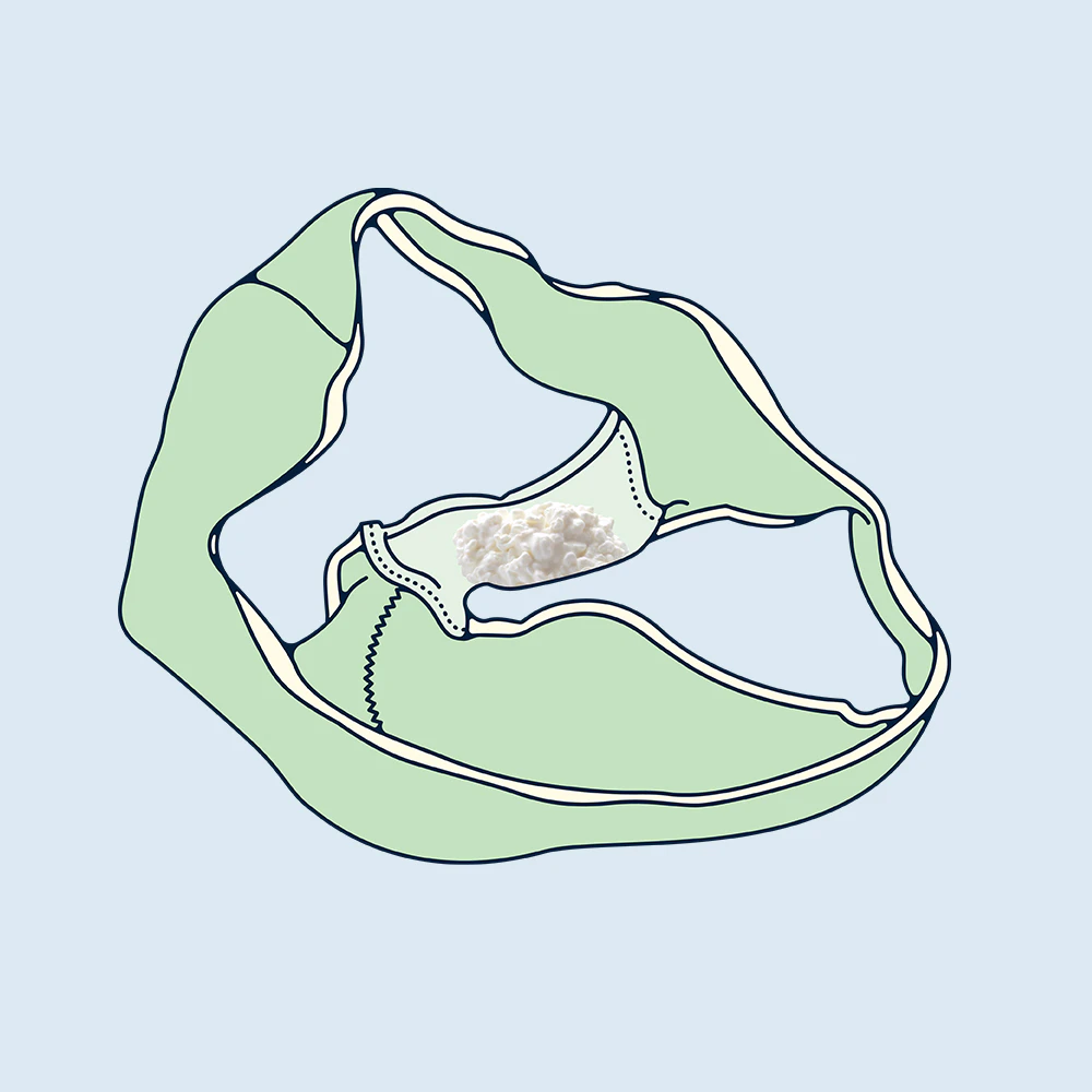 This Is Why You’re More Likely To Get Yeast infection On Your Period