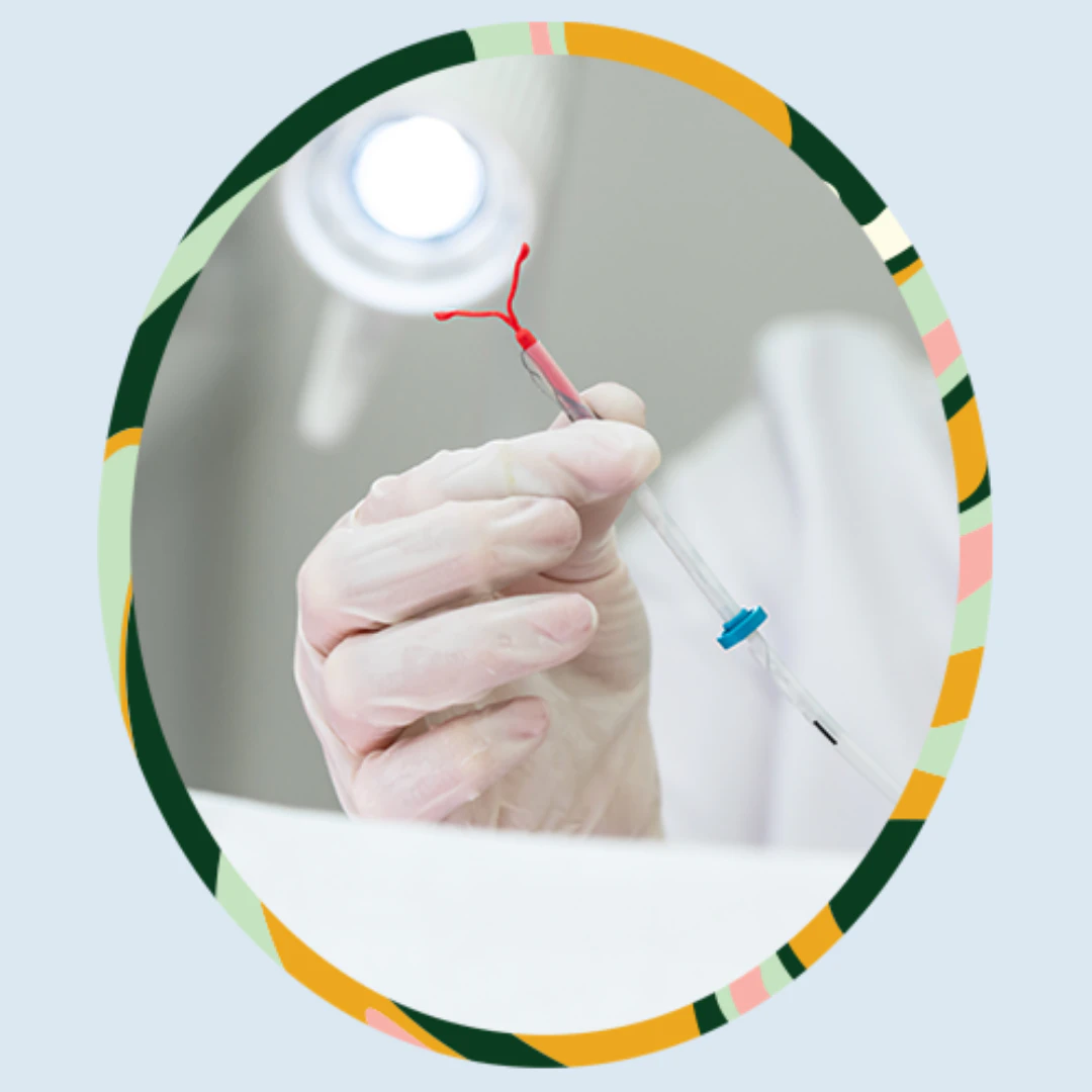 What It's Really Like to Have intrauterine Device (IUD) Fitted