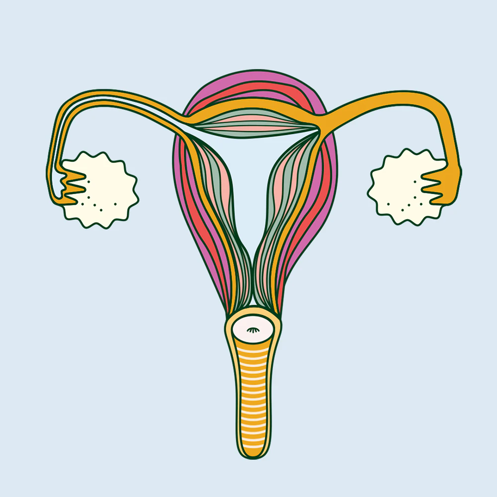What is endometriosis
