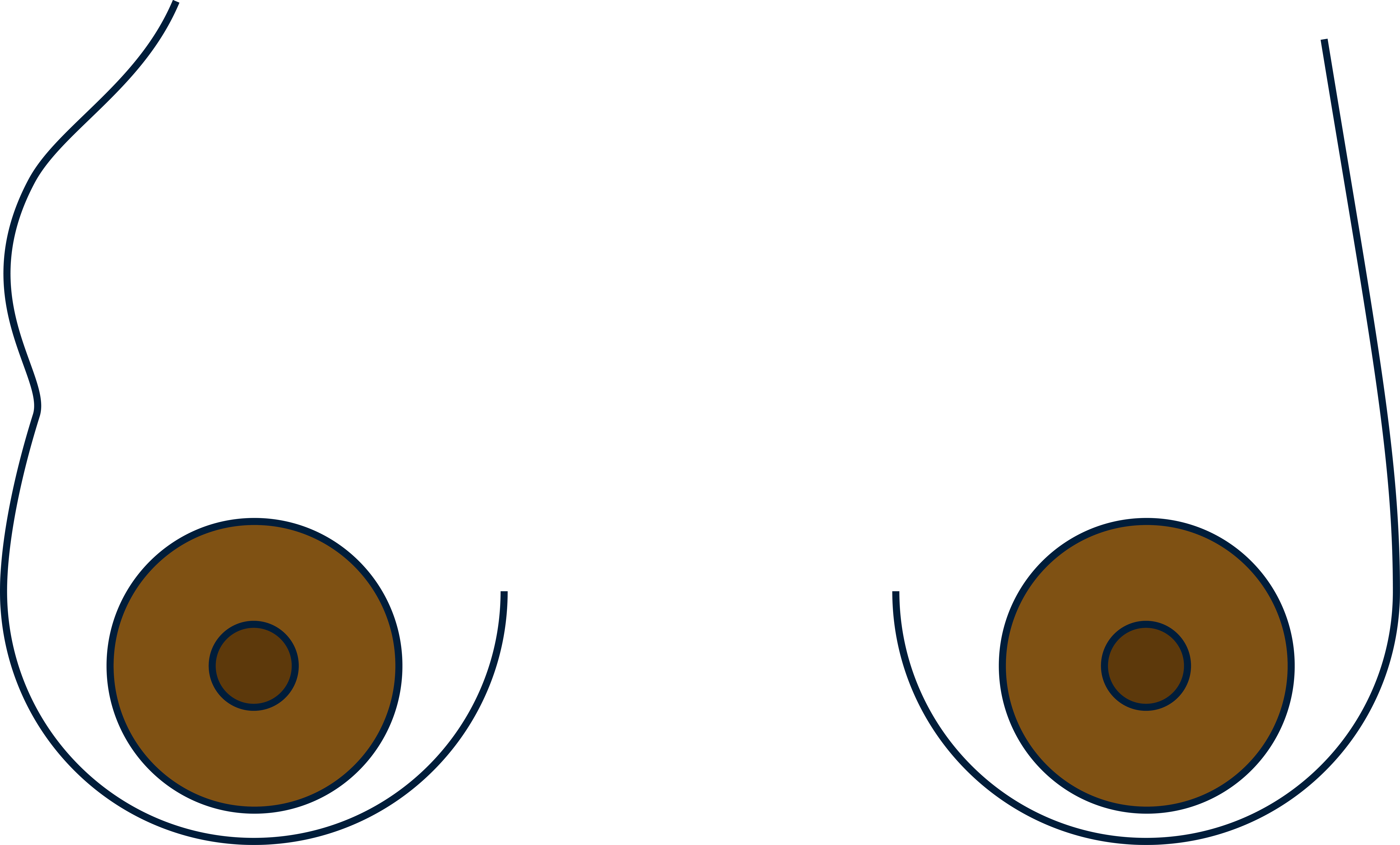 Breast swelling