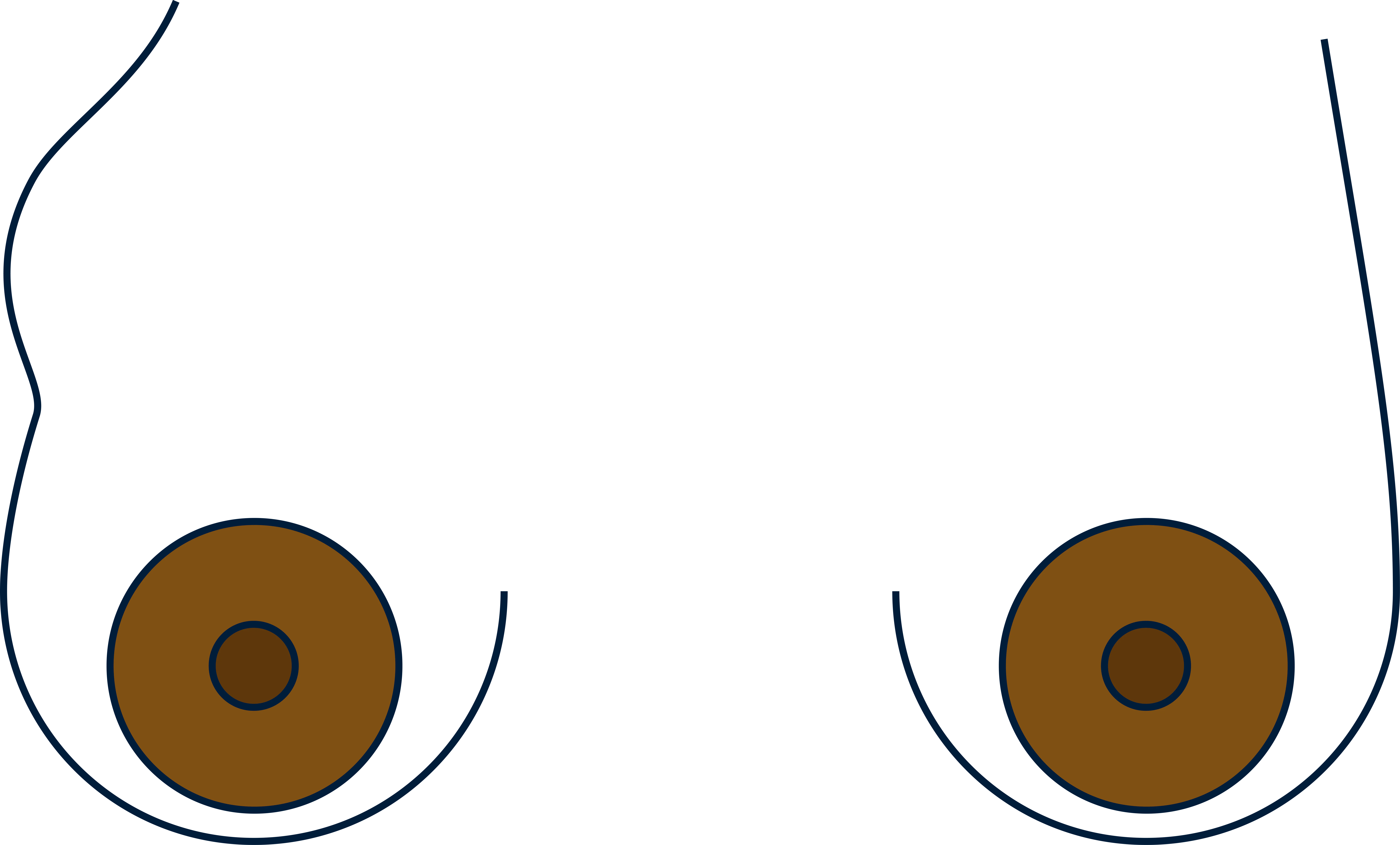 Breast swelling