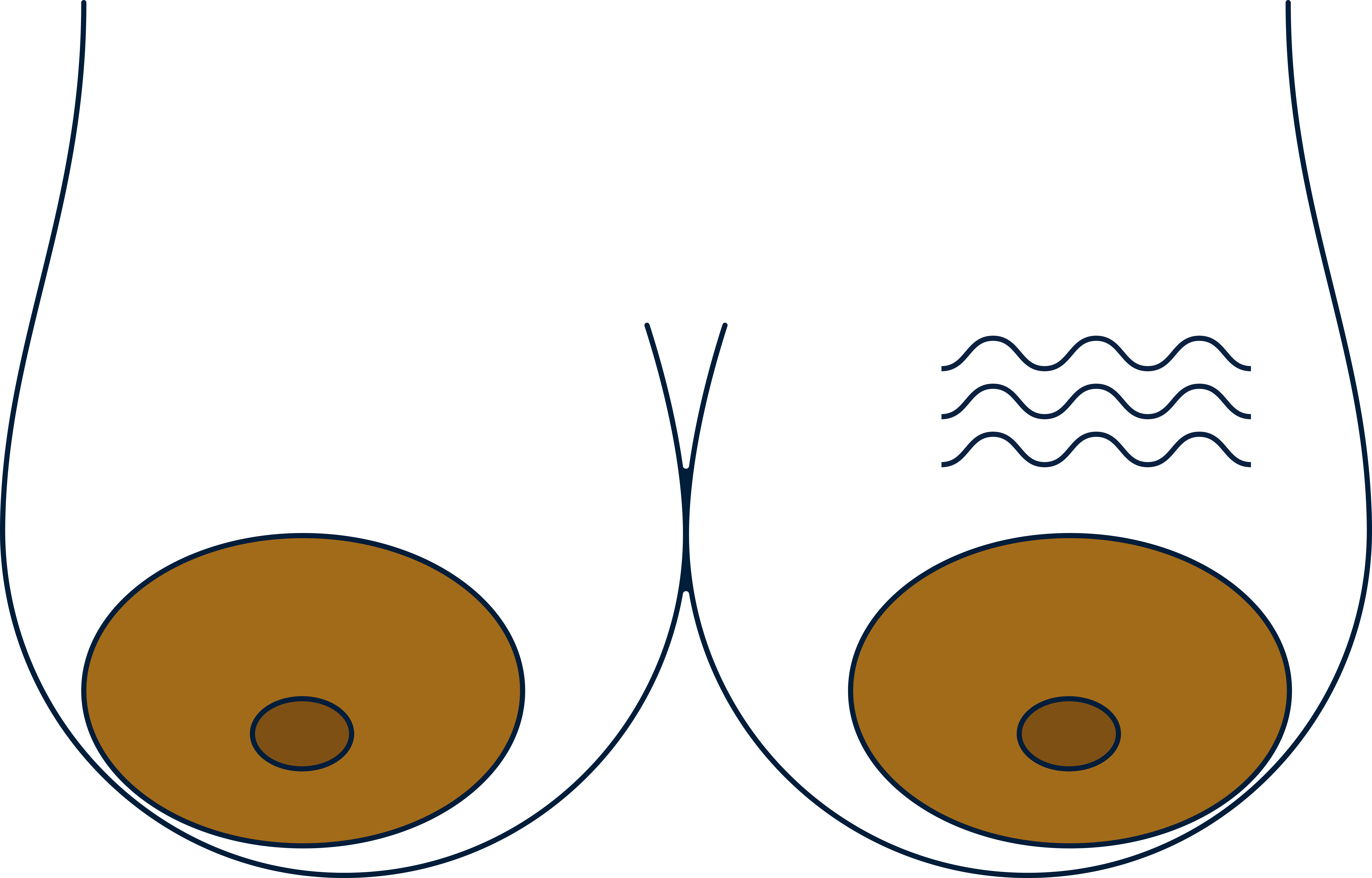 Changes in breast skin texture, signs of breast cancer