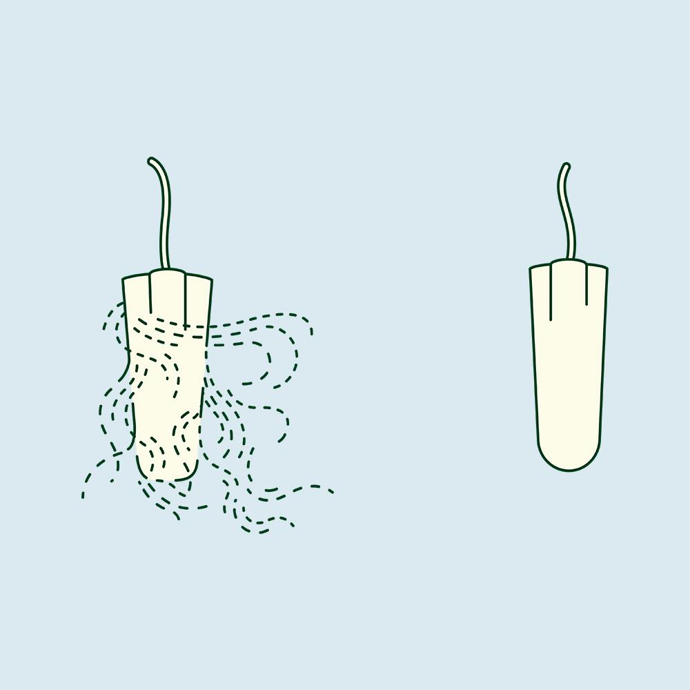 What Is Tampon Fibre Loss?