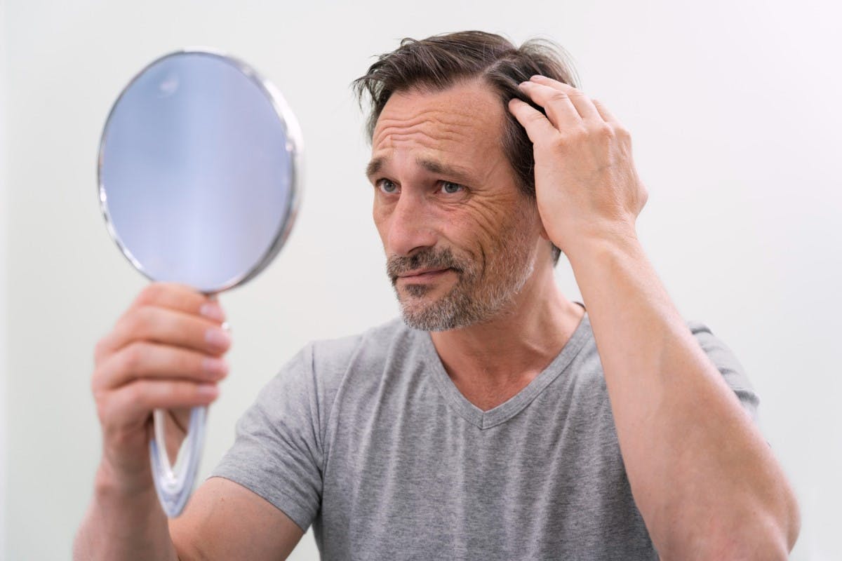 ¿Cómo Es Que La Diabetes Causa La Pérdida Del Cabello?