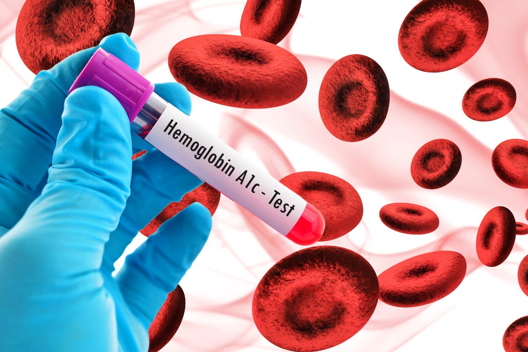Cómo Reducir Los Niveles de A1c (Hemoglobina)