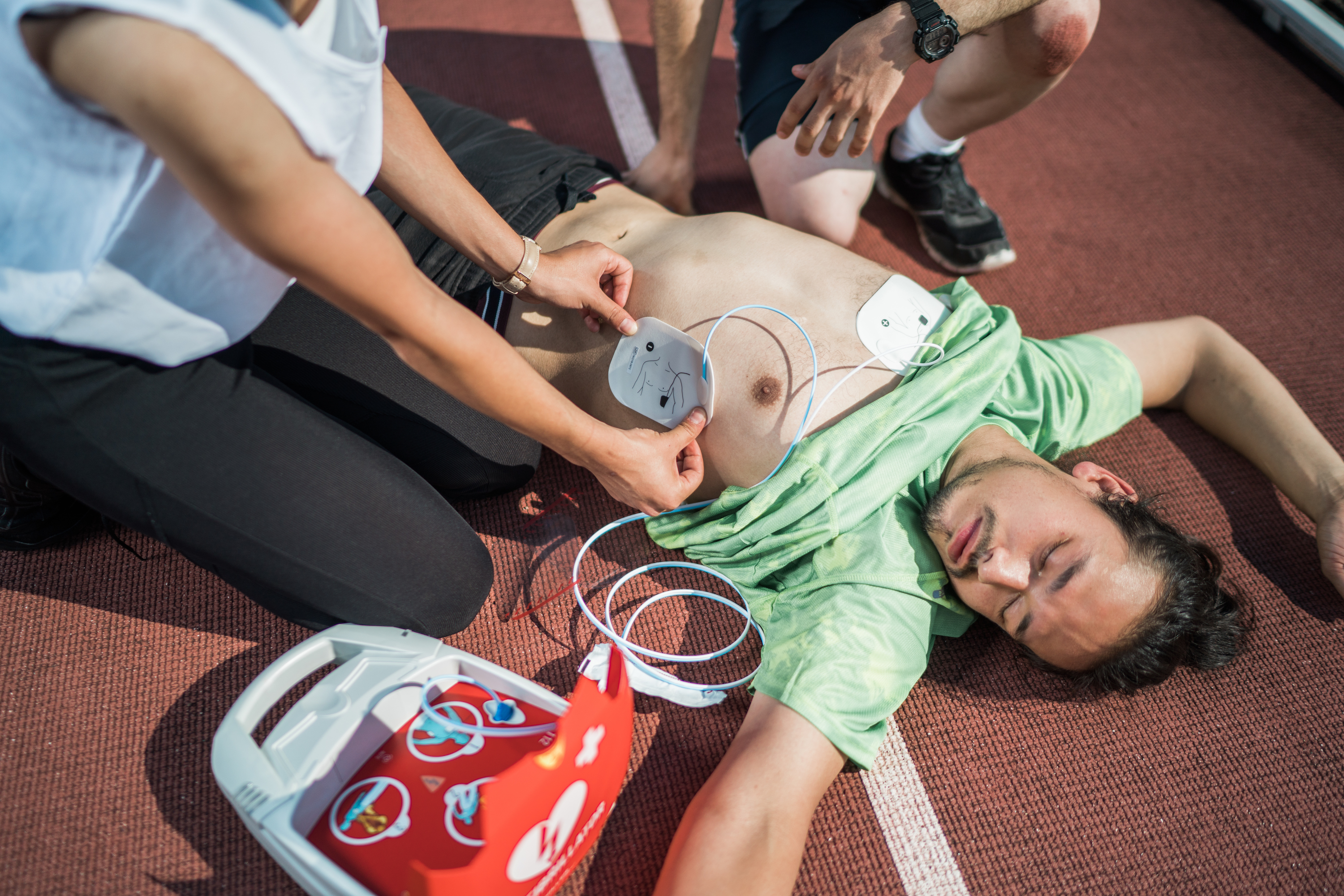posizione piastre defibrillatore