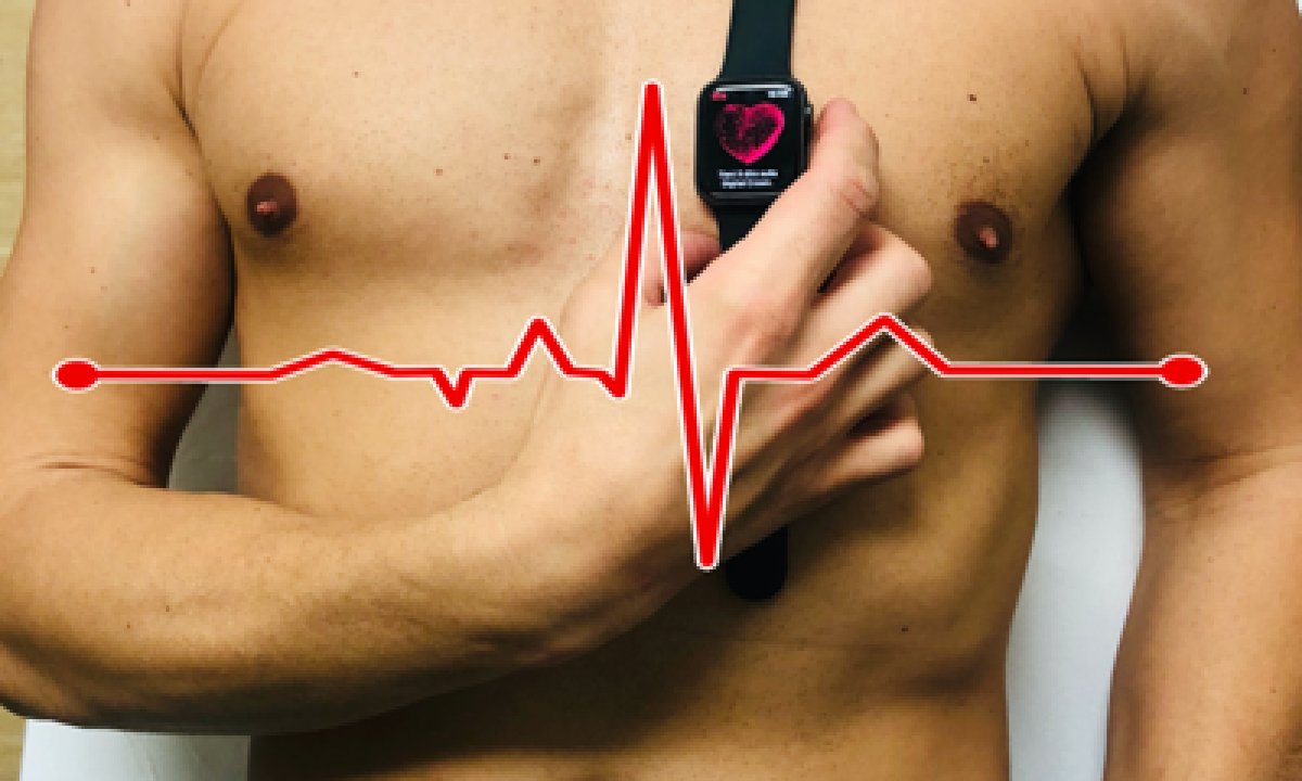 smartwatch infarto