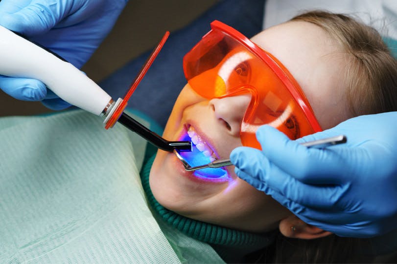 sigilare dentara la stomatolog copil cu dinti permanenti | Dental Hygiene Center