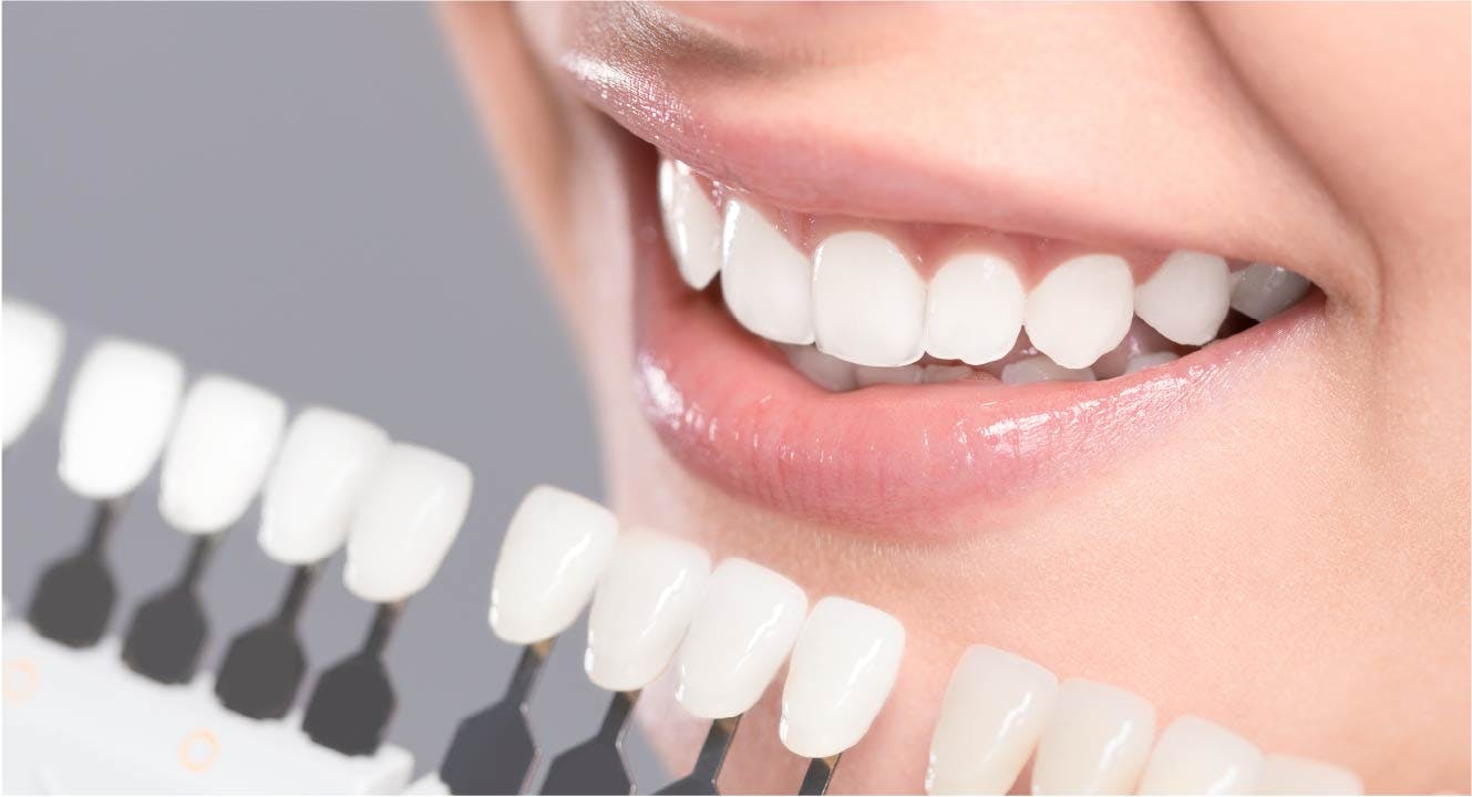 Dinti albi - Dental Hygiene Center 