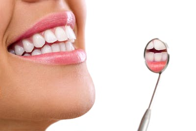 Dinti albi | Albire dentară | Dental Hygiene Center