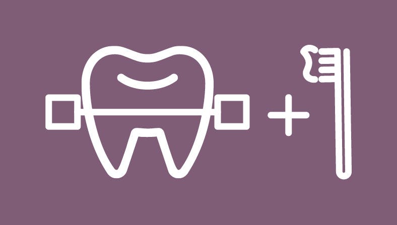 Abonament Ortho Smile - Dental Hygiene Center