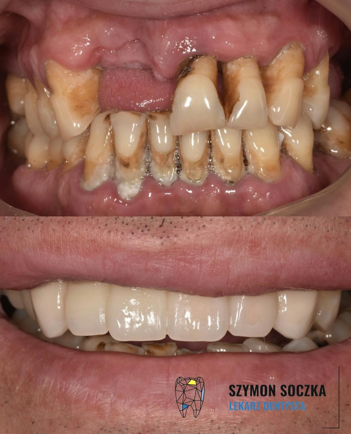 Metamorfozy stomatologiczne