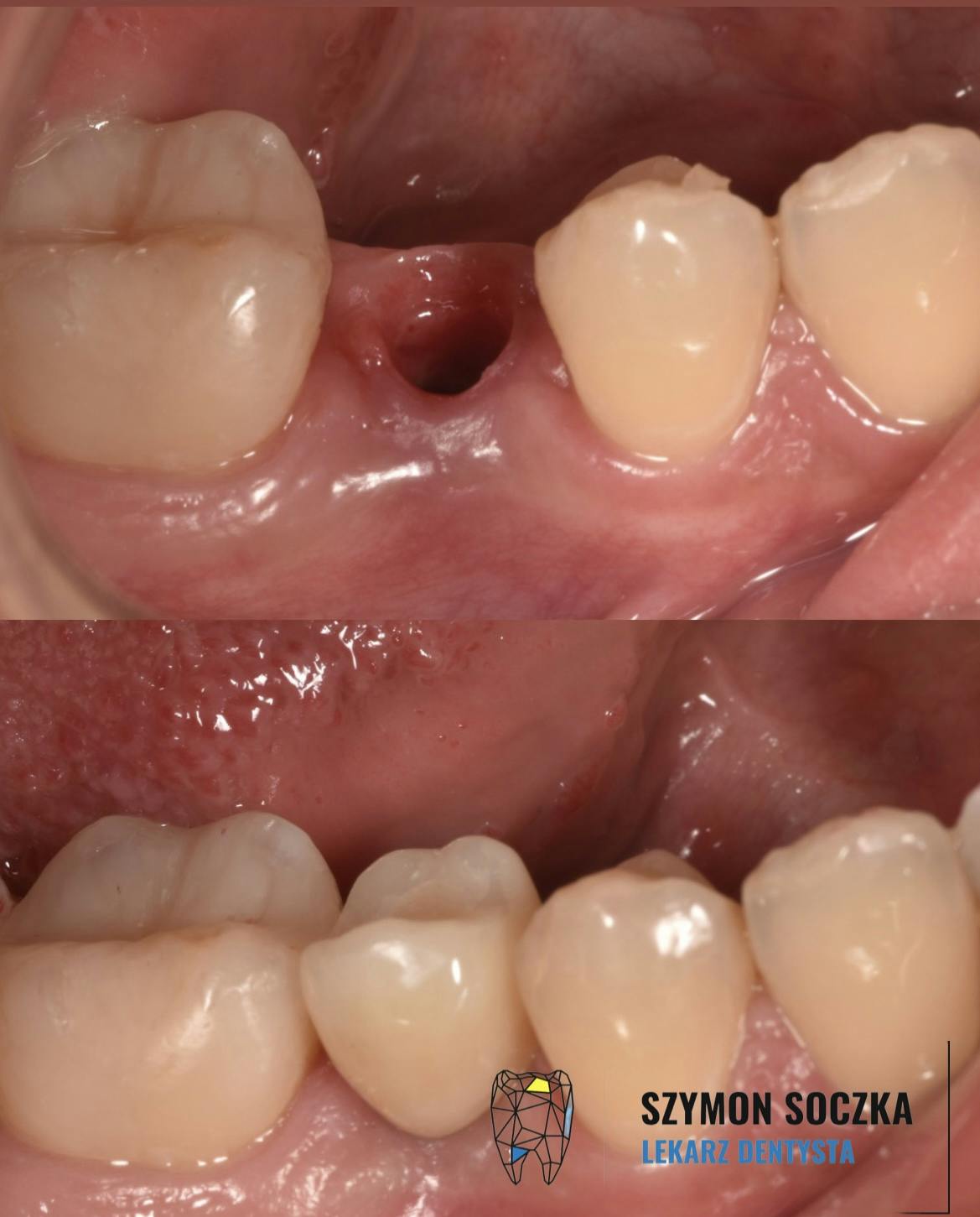 Metamorfozy stomatologiczne