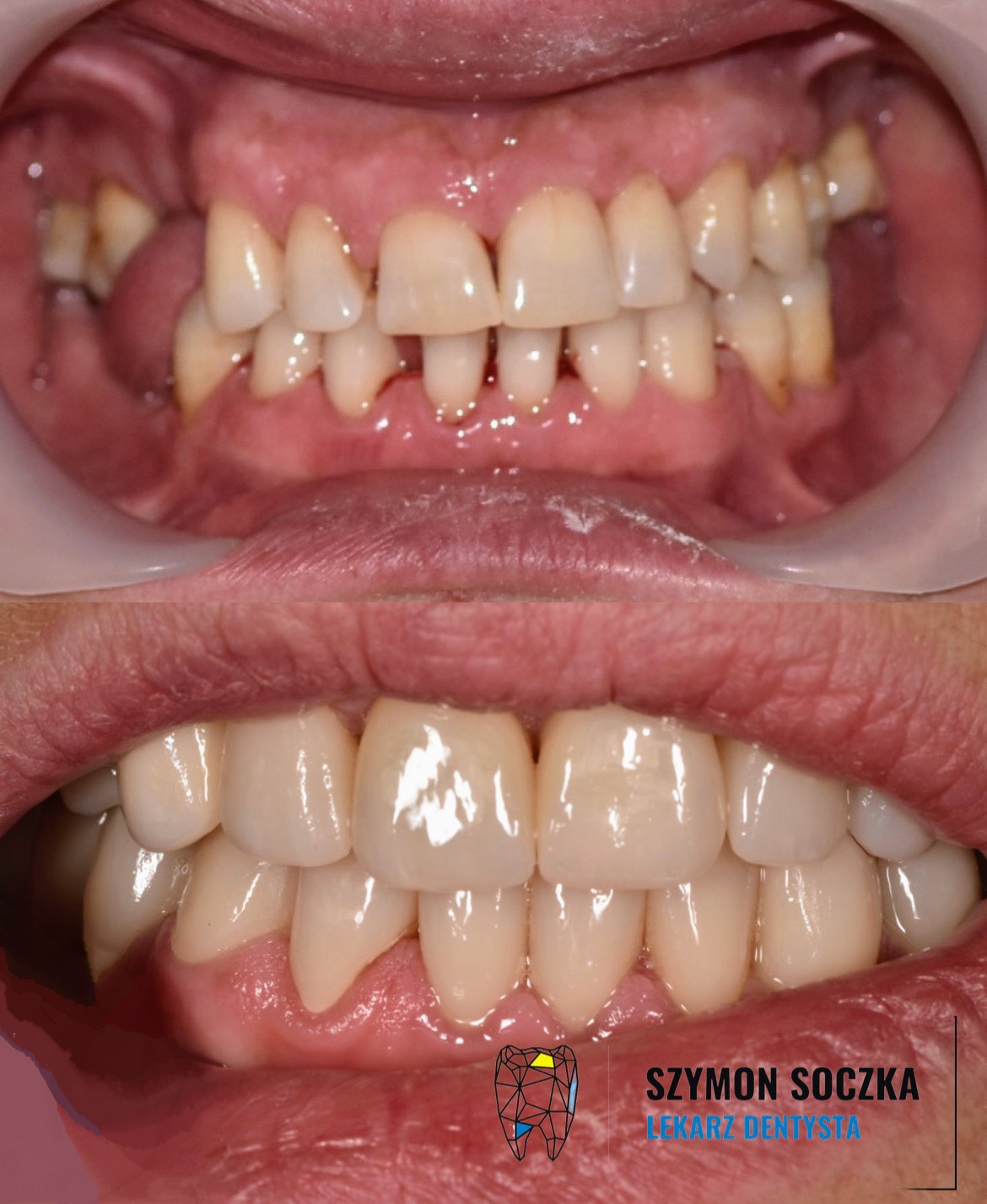 Metamorfozy stomatologiczne