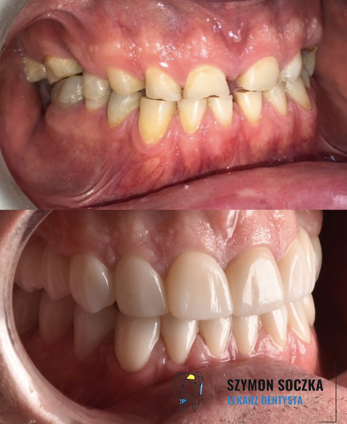 Metamorfozy stomatologiczne