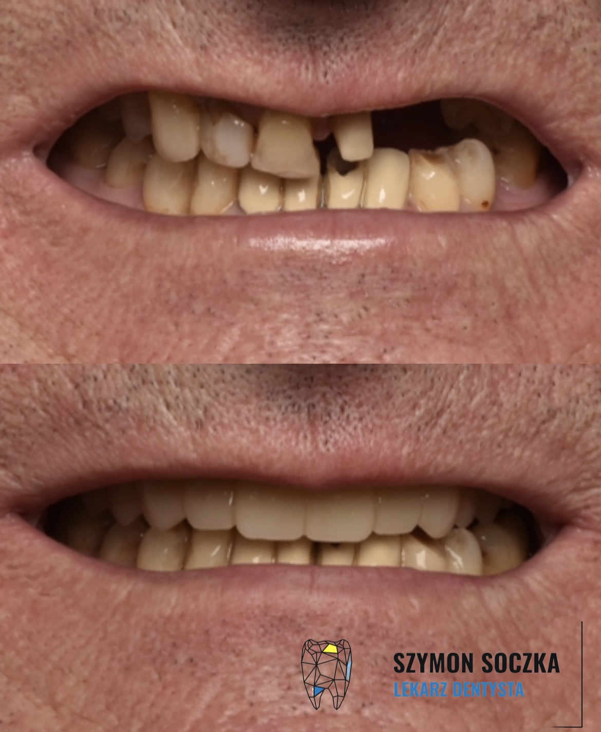 Metamorfozy stomatologiczne