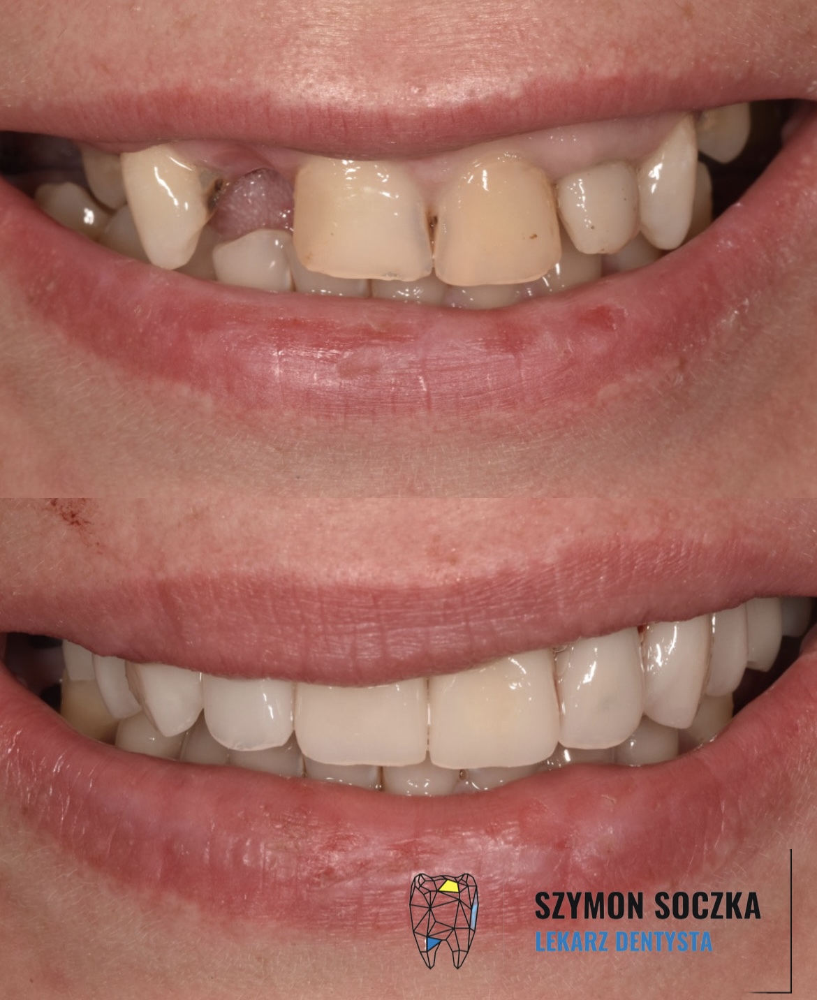 Metamorfozy stomatologiczne