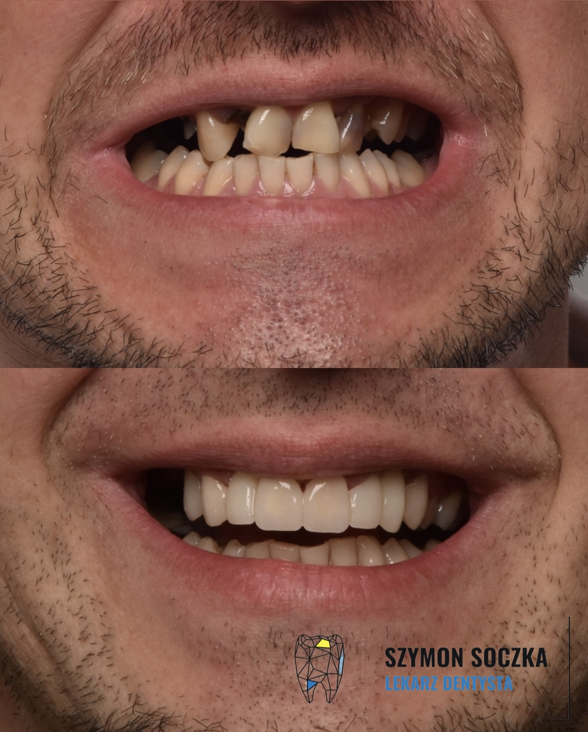 Metamorfozy stomatologiczne