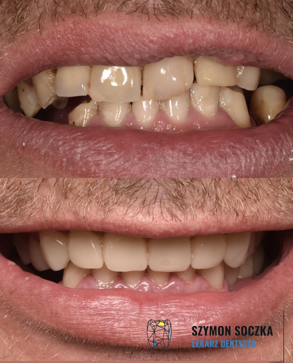 Metamorfozy stomatologiczne