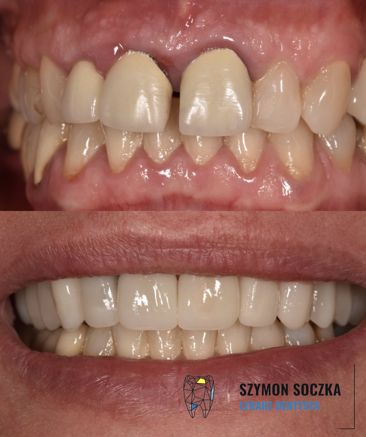 Metamorfozy stomatologiczne