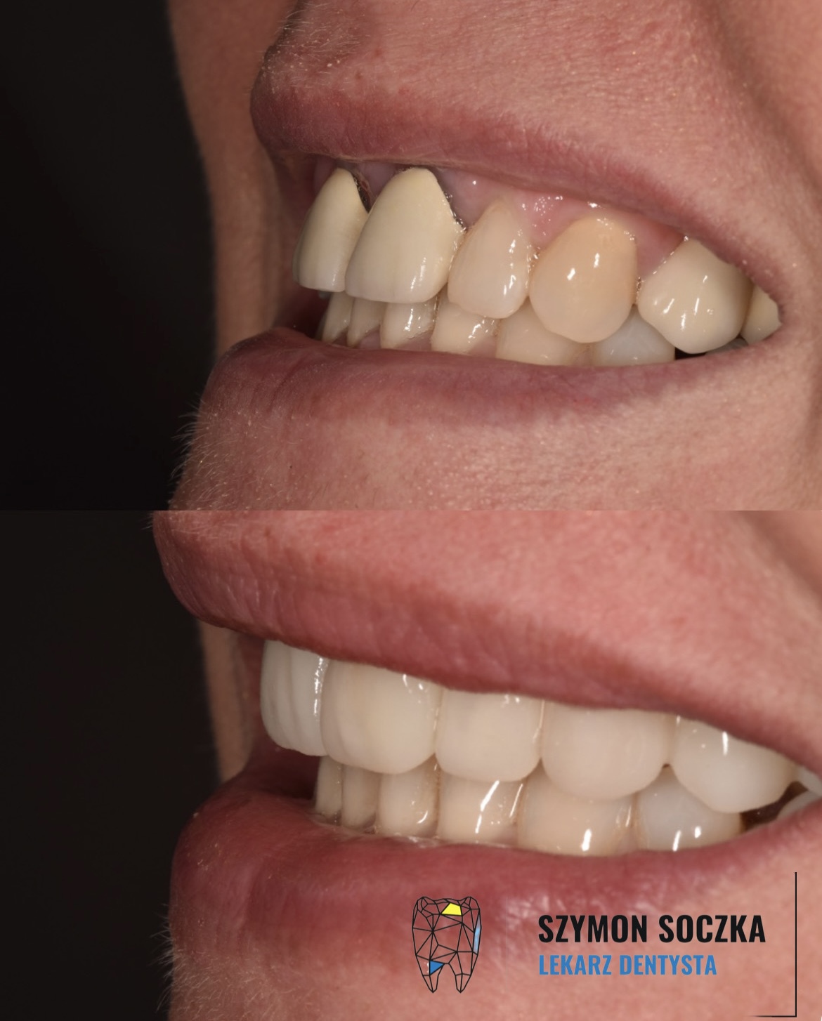 Metamorfozy stomatologiczne