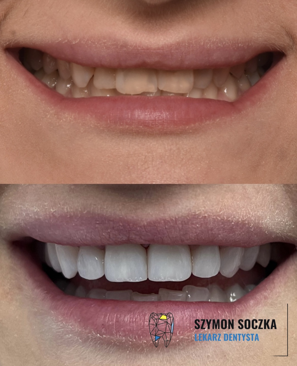 Metamorfozy stomatologiczne