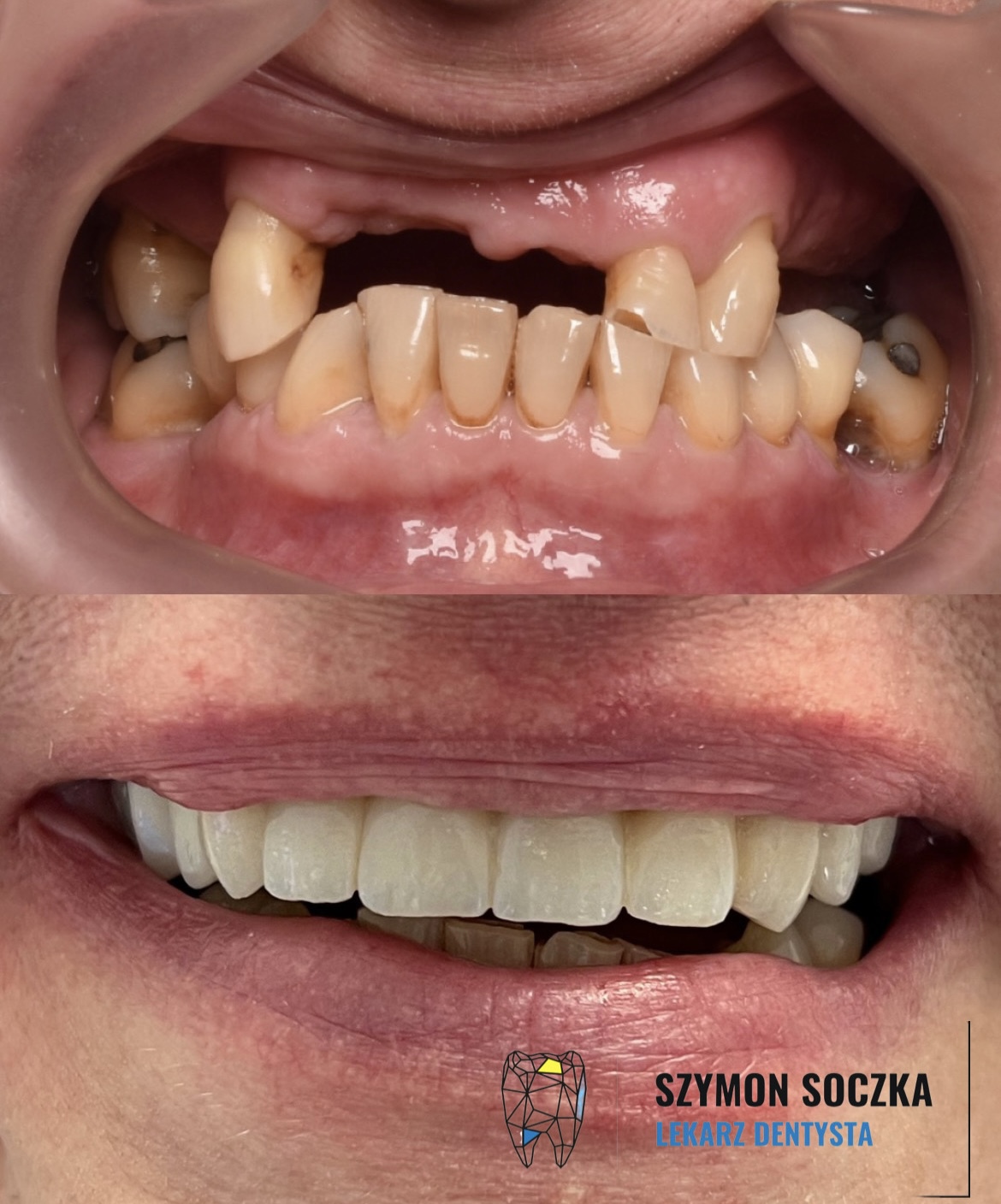 Metamorfozy stomatologiczne