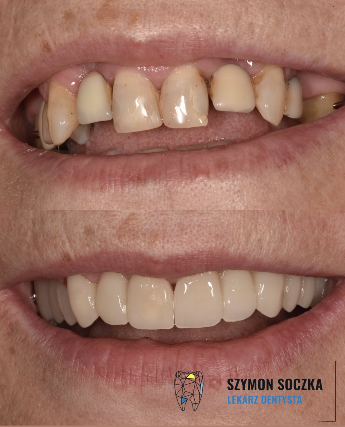 Metamorfozy stomatologiczne