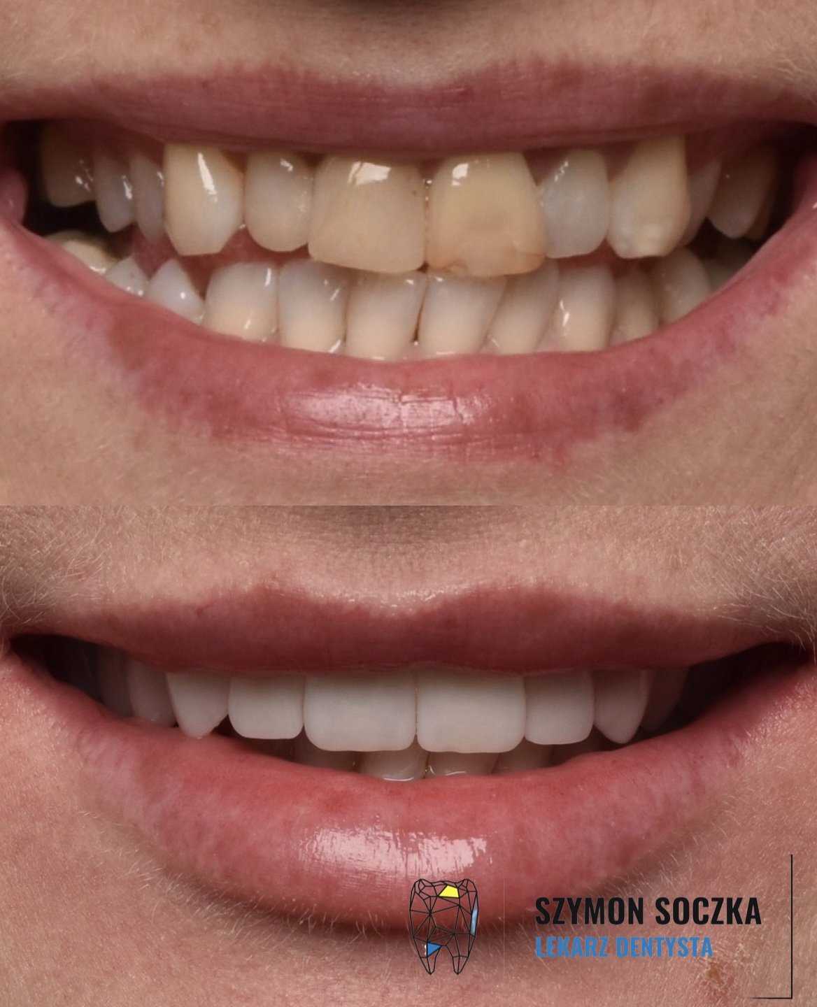 Metamorfozy stomatologiczne