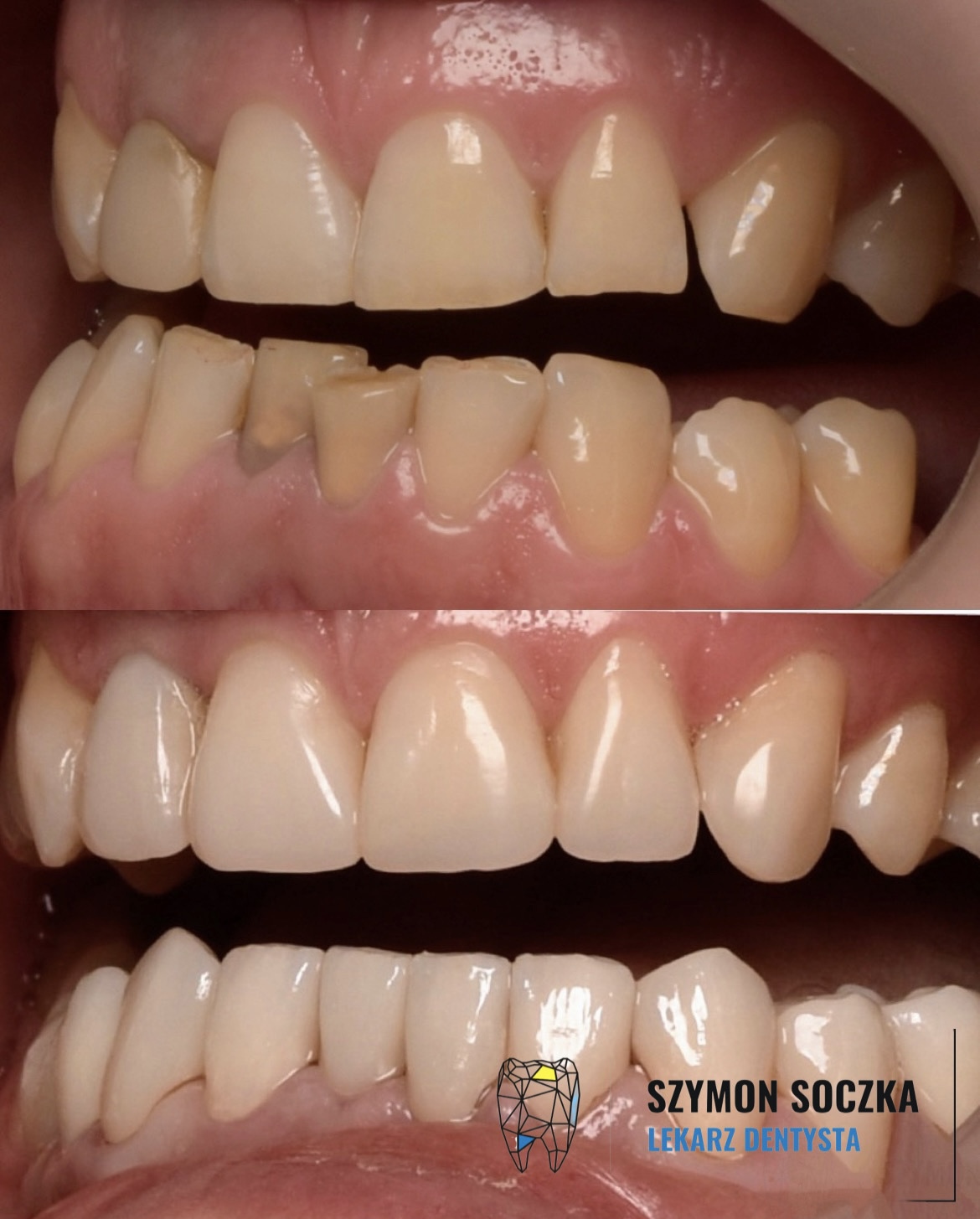 Metamorfozy stomatologiczne