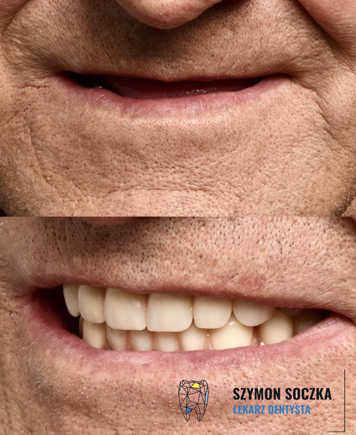 Metamorfozy stomatologiczne