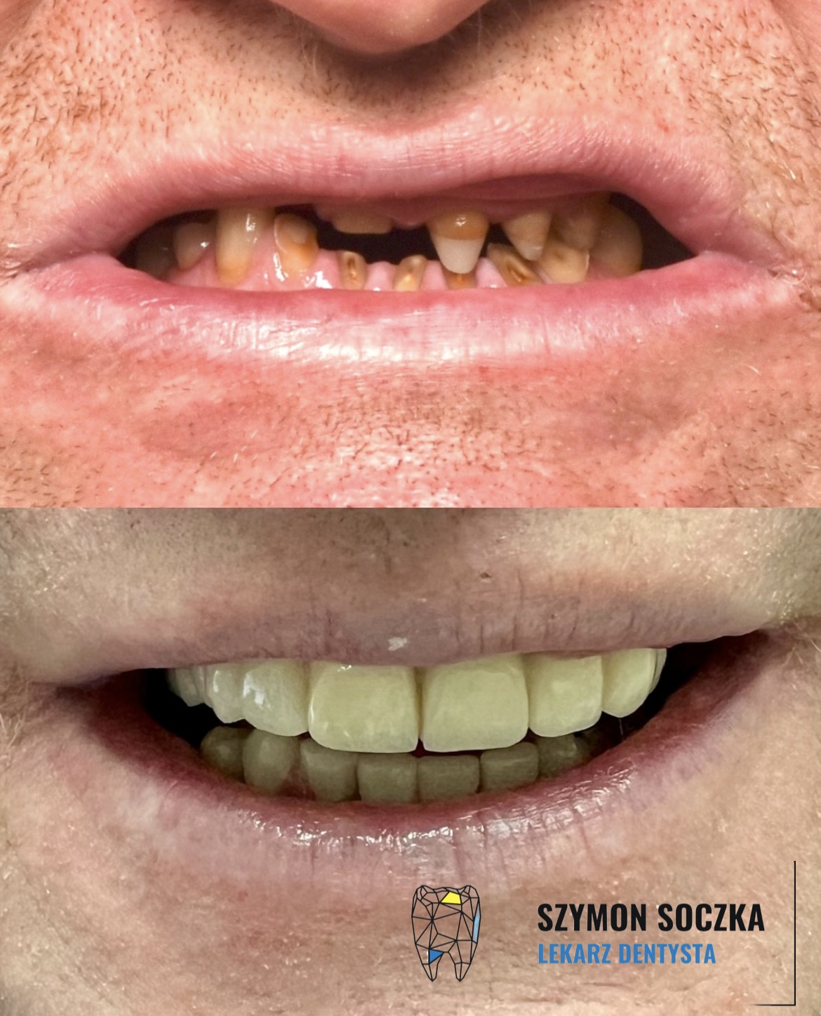 Metamorfozy stomatologiczne