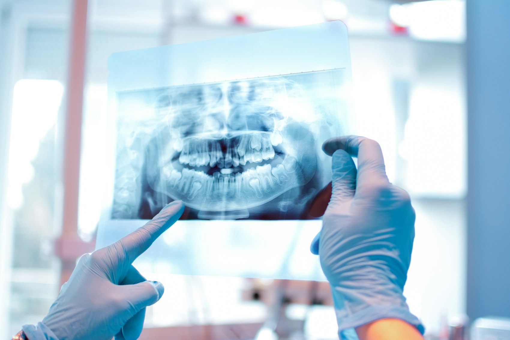 Zwei Hände halten das Röntgenbild von Zähnen ins Licht.