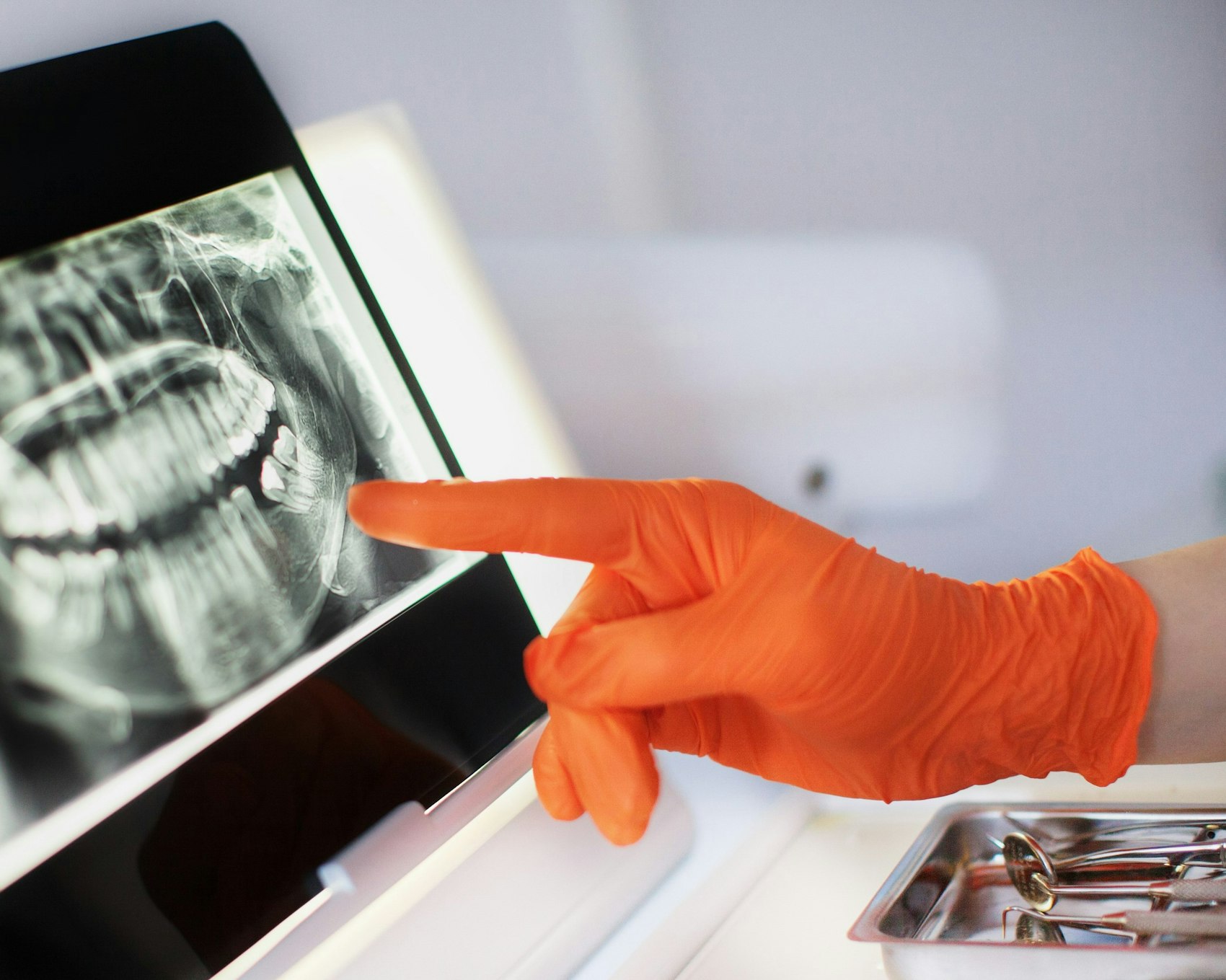 Eine Hand mit orangefarbenem Handschuh bekleidet zeigt auf das digitale Röntgenbild eines Kiefers.