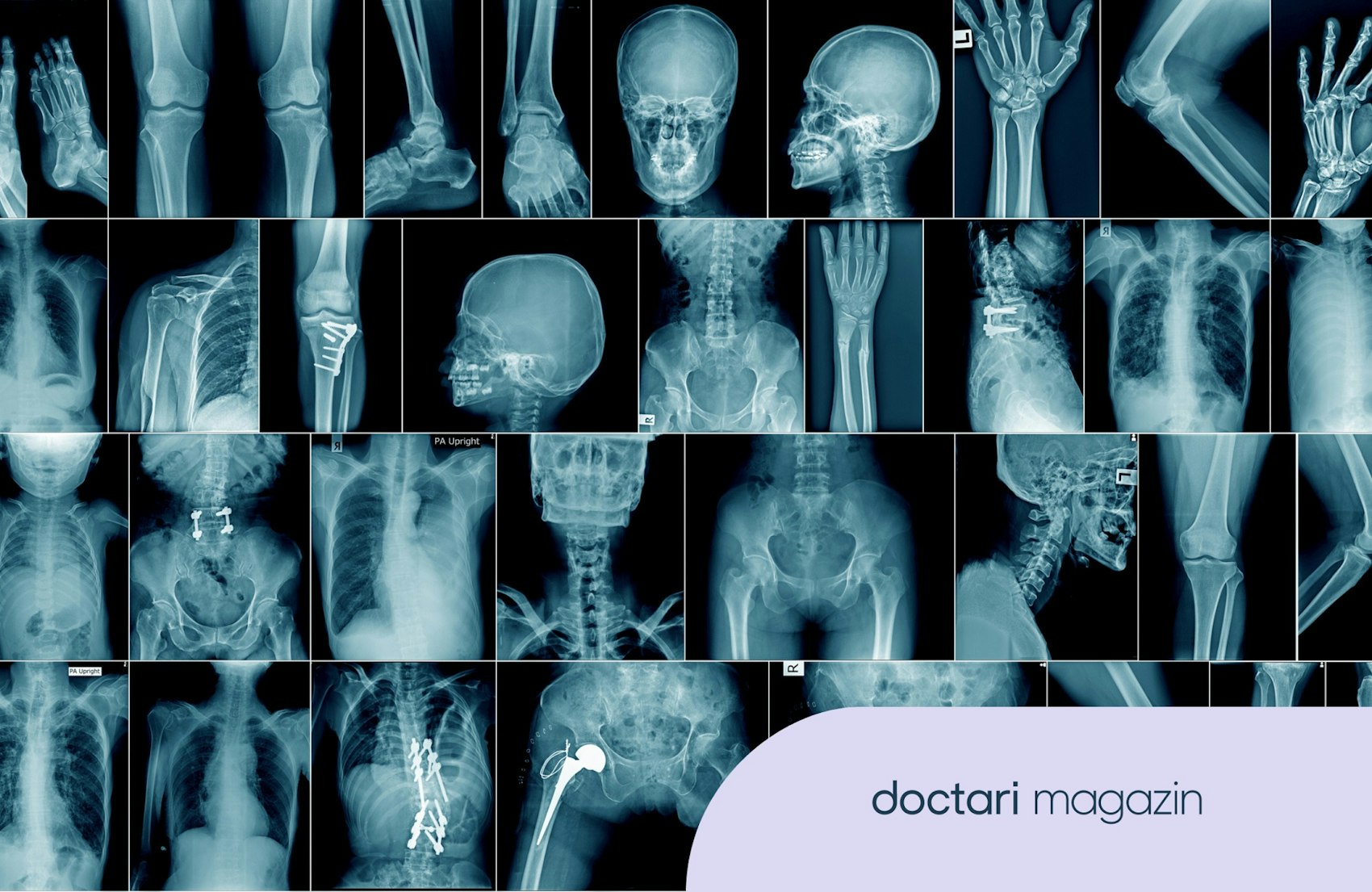 Eine Vielzahl an Röntgenbildern zeigt verschiedene menschliche Körperteile.