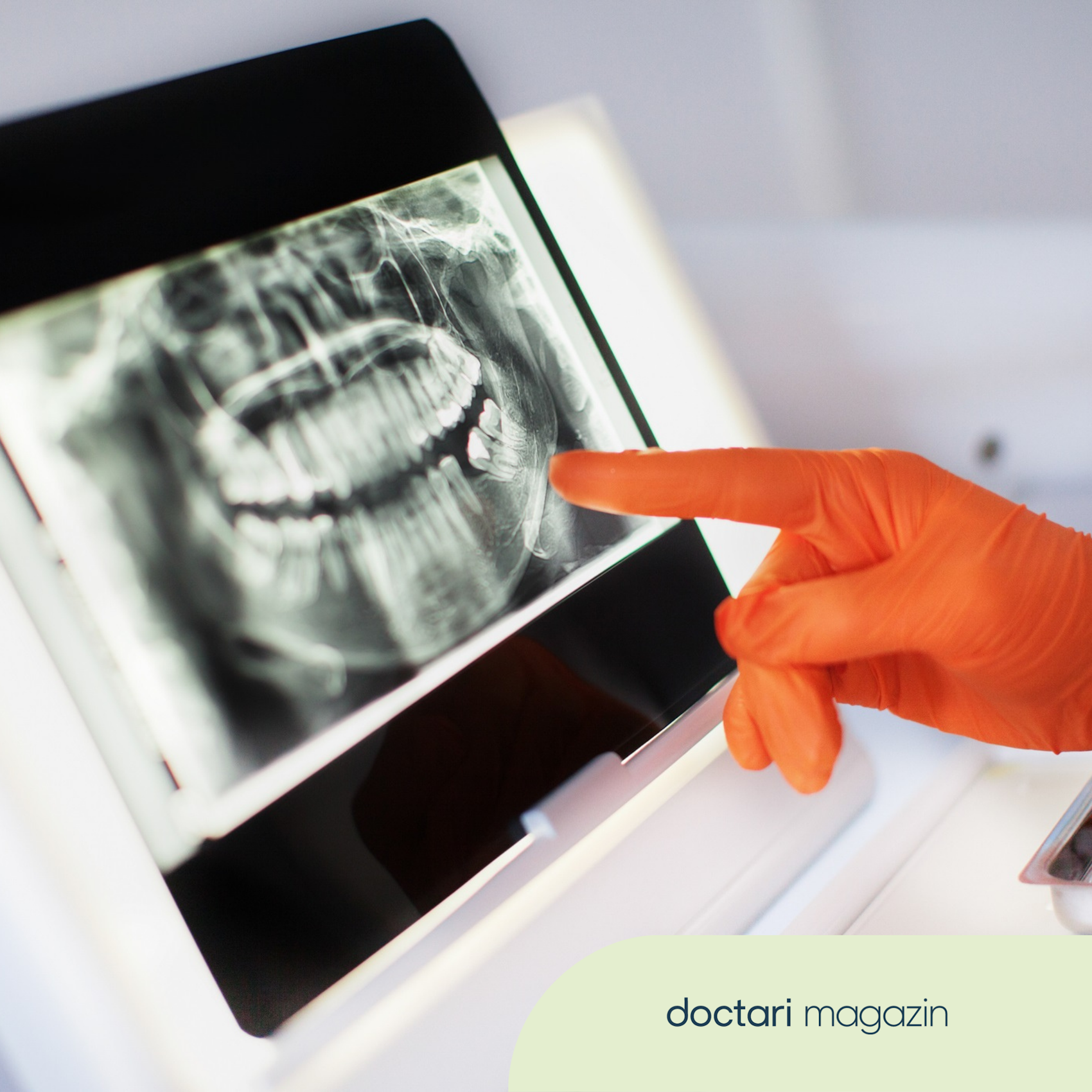 Röntgenschein: Ein Finger einer MFA zeigt auf das Röntgenbild eines Kiefers.