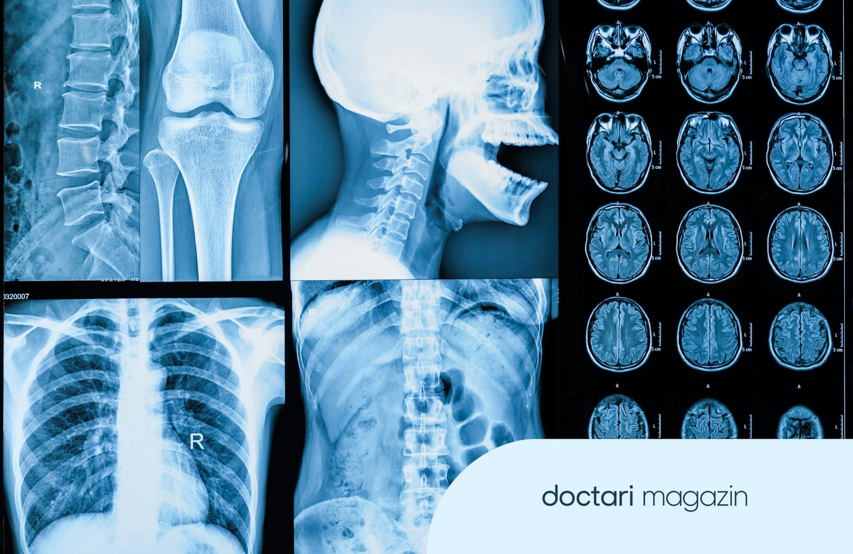 Sammlung von Röntgen- und MRT-Bildern
