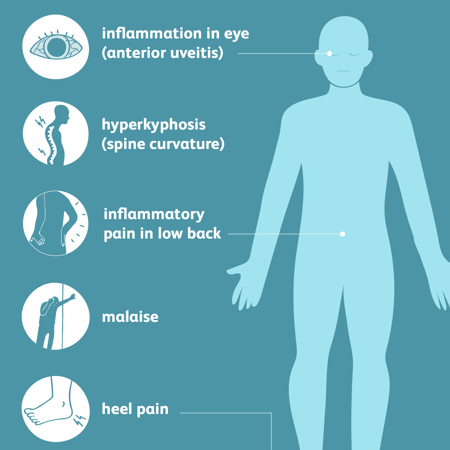 Мрох симптомы. Гипераммониемия проявления. Мрох симптомы. Кишечные проявления болезни крона. Системная красная волчанка это аутоиммунное заболевание.