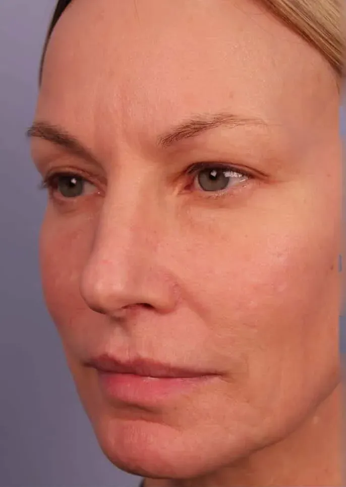 Öncesi 1