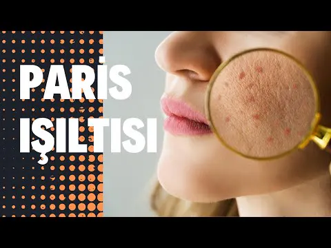 Paris ışıltısı işlemi ile gençleşmek mümkün!